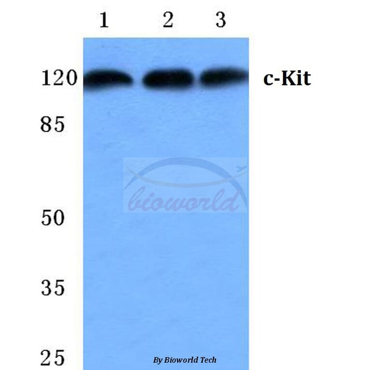 Anti-c-Kit (E930) Antibody from Bioworld Technology (BS2433) - Antibodies.com