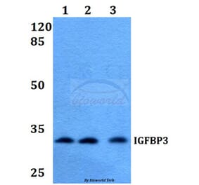 Anti-IGFBP3 (H179) Antibody from Bioworld Technology (BS2439) - Antibodies.com