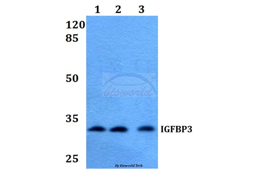 Anti-IGFBP3 (H179) Antibody from Bioworld Technology (BS2439) - Antibodies.com