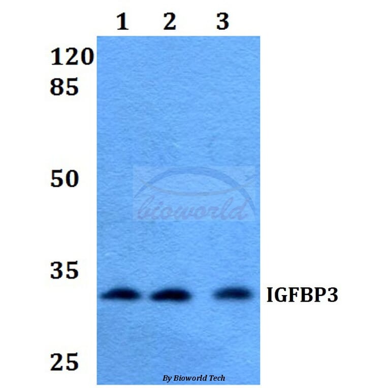 Anti-IGFBP3 (H179) Antibody from Bioworld Technology (BS2439) - Antibodies.com