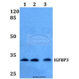 Anti-IGFBP3 (H179) Antibody from Bioworld Technology (BS2439) - Antibodies.com