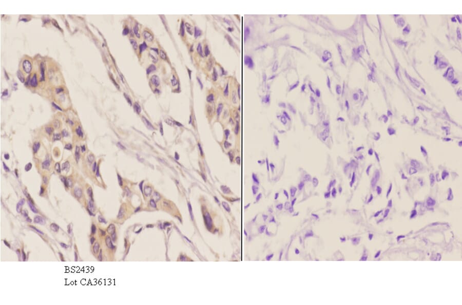 Anti-IGFBP3 (H179) Antibody from Bioworld Technology (BS2439) - Antibodies.com