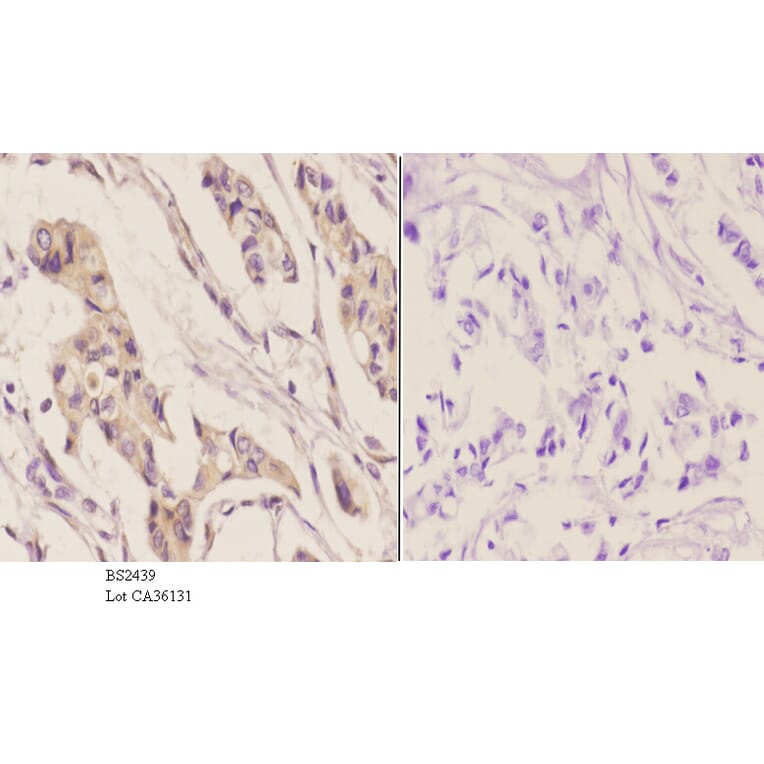 Anti-IGFBP3 (H179) Antibody from Bioworld Technology (BS2439) - Antibodies.com