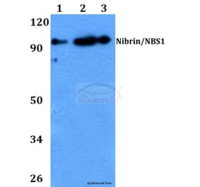 Anti-Nibrin / NBS1 (G274) Antibody from Bioworld Technology (BS2441) - Antibodies.com