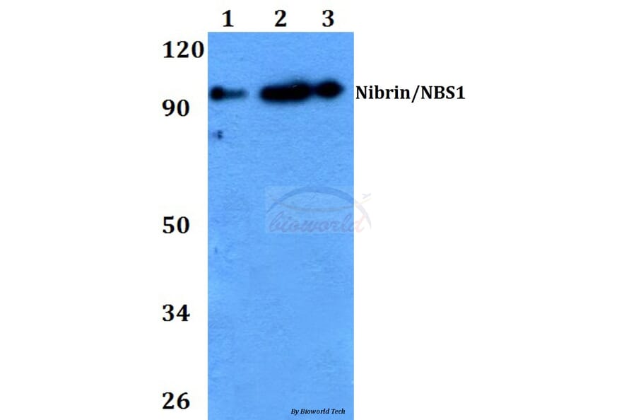 Anti-Nibrin / NBS1 (G274) Antibody from Bioworld Technology (BS2441) - Antibodies.com