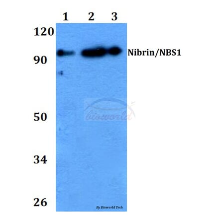 Anti-Nibrin / NBS1 (G274) Antibody from Bioworld Technology (BS2441) - Antibodies.com