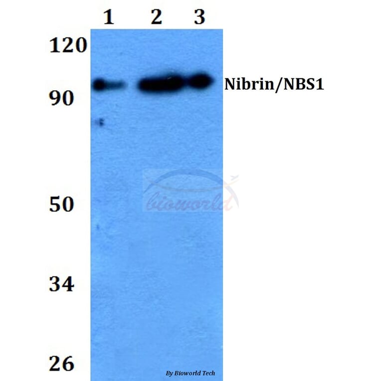 Anti-Nibrin / NBS1 (G274) Antibody from Bioworld Technology (BS2441) - Antibodies.com