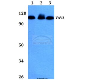 Anti-VAV2 (D138) Antibody from Bioworld Technology (BS2443) - Antibodies.com