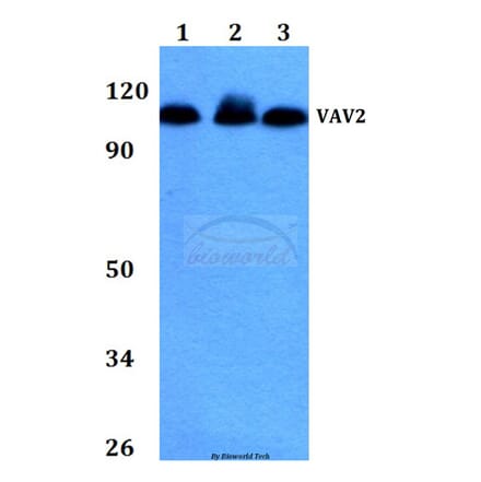 Anti-VAV2 (D138) Antibody from Bioworld Technology (BS2443) - Antibodies.com