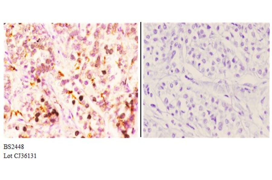 Anti-Hrs (R481) Antibody from Bioworld Technology (BS2448) - Antibodies.com