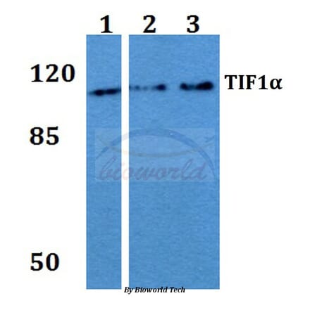 Anti-TIF1α (Q1034) Antibody from Bioworld Technology (BS2449) - Antibodies.com
