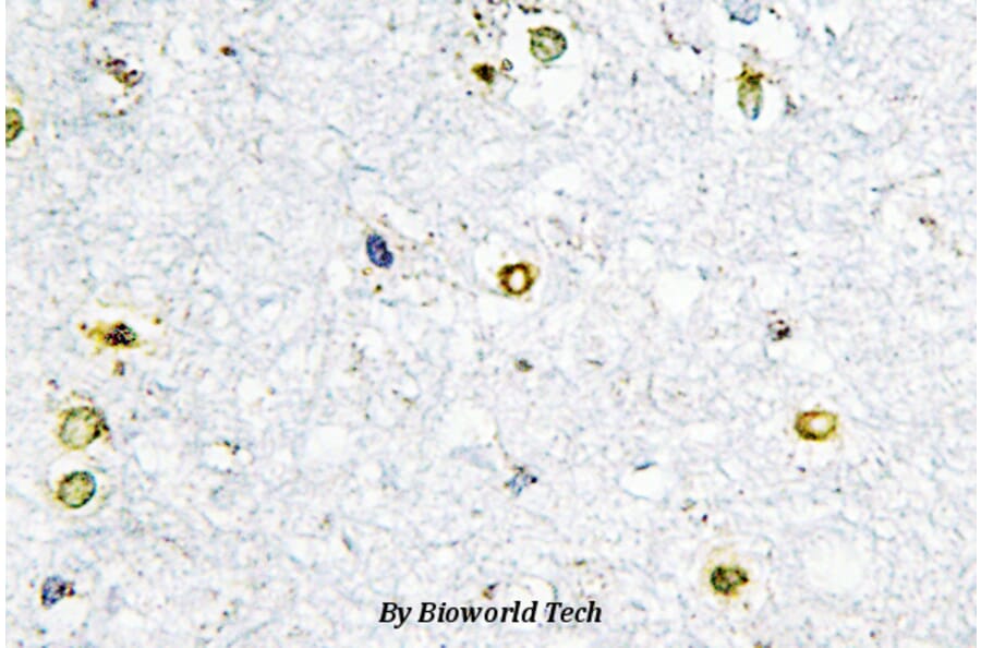 Anti-TIF1α (Q1034) Antibody from Bioworld Technology (BS2449) - Antibodies.com