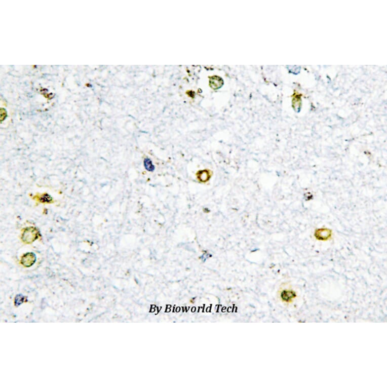 Anti-TIF1α (Q1034) Antibody from Bioworld Technology (BS2449) - Antibodies.com