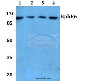 Anti-EphB6 (D881) Antibody from Bioworld Technology (BS2450) - Antibodies.com