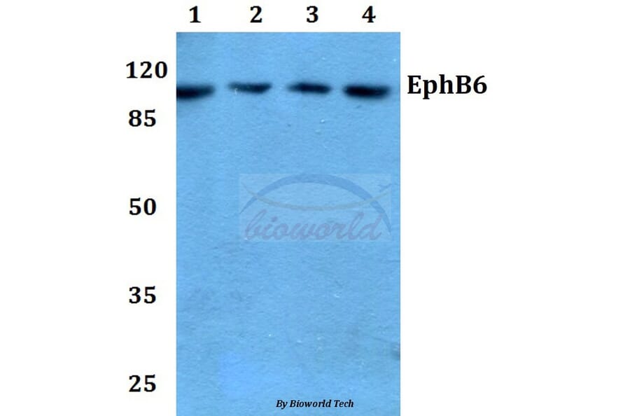Anti-EphB6 (D881) Antibody from Bioworld Technology (BS2450) - Antibodies.com
