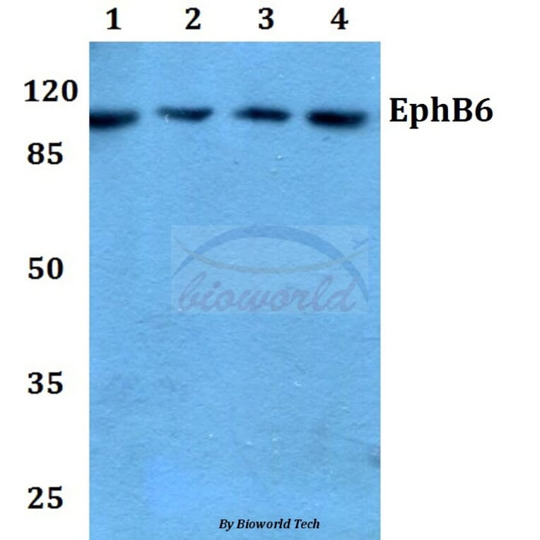 Anti-EphB6 (D881) Antibody from Bioworld Technology (BS2450) - Antibodies.com