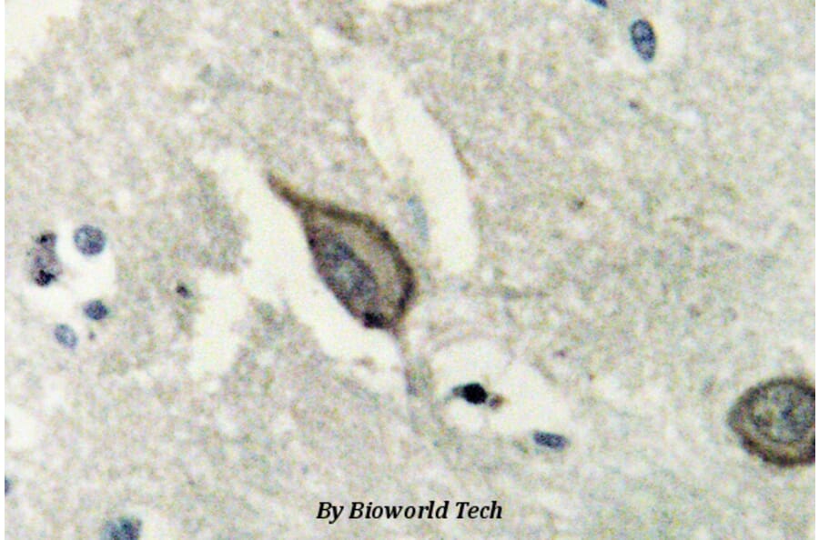 Anti-EphB6 (D881) Antibody from Bioworld Technology (BS2450) - Antibodies.com