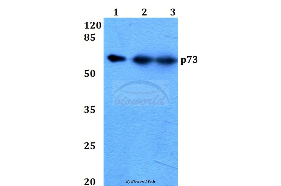 Anti-p73 (P298) Antibody from Bioworld Technology (BS2452) - Antibodies.com
