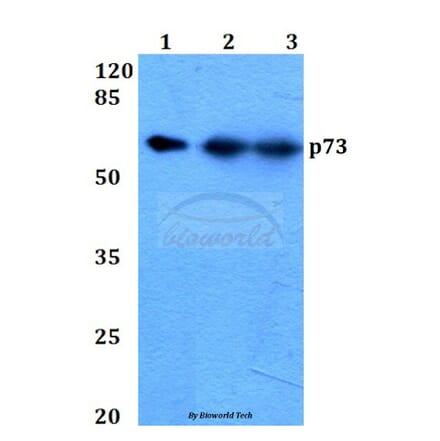 Anti-p73 (P298) Antibody from Bioworld Technology (BS2452) - Antibodies.com