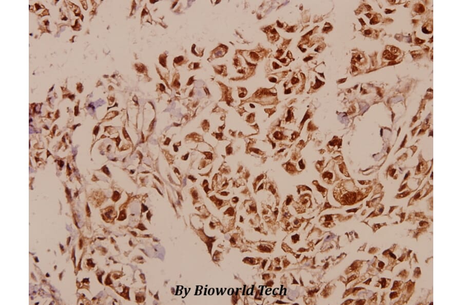 Anti-p73 (P298) Antibody from Bioworld Technology (BS2452) - Antibodies.com