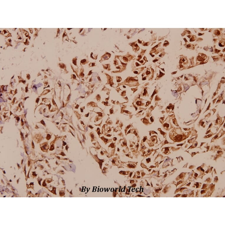 Anti-p73 (P298) Antibody from Bioworld Technology (BS2452) - Antibodies.com