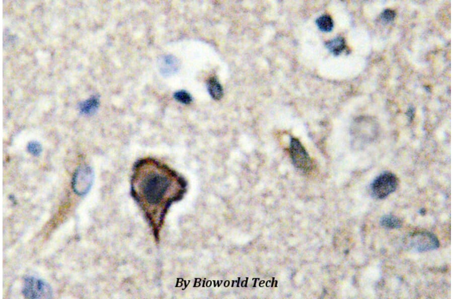 Anti-TWEAK (P73) Antibody from Bioworld Technology (BS2454) - Antibodies.com