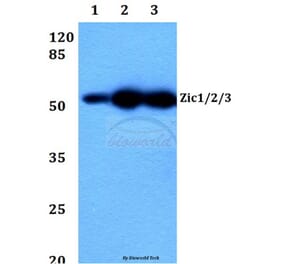 Anti-Zic1/2/3 (D348) Antibody from Bioworld Technology (BS2455) - Antibodies.com