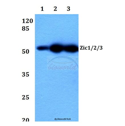 Anti-Zic1/2/3 (D348) Antibody from Bioworld Technology (BS2455) - Antibodies.com