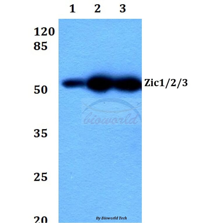 Anti-Zic1/2/3 (D348) Antibody from Bioworld Technology (BS2455) - Antibodies.com