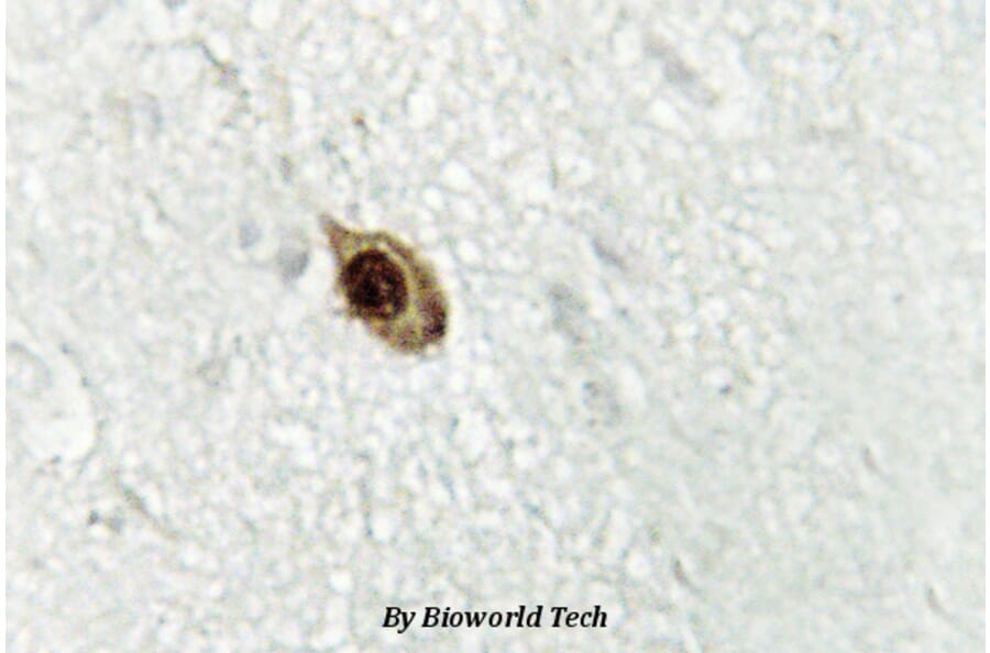Anti-Zic1/2/3 (D348) Antibody from Bioworld Technology (BS2455) - Antibodies.com