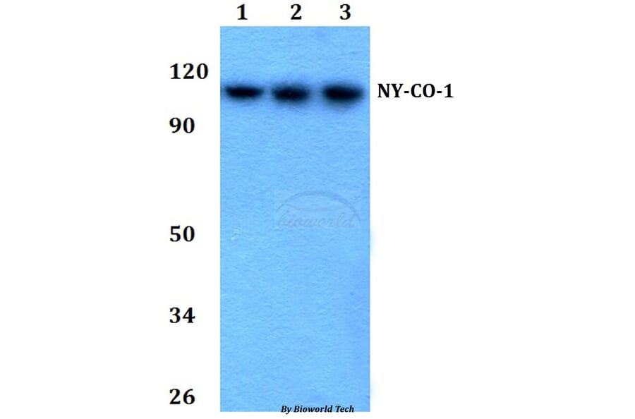 Anti-NY-CO-1 (K914) Antibody from Bioworld Technology (BS2456) - Antibodies.com
