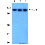 Anti-NY-CO-1 (K914) Antibody from Bioworld Technology (BS2456) - Antibodies.com