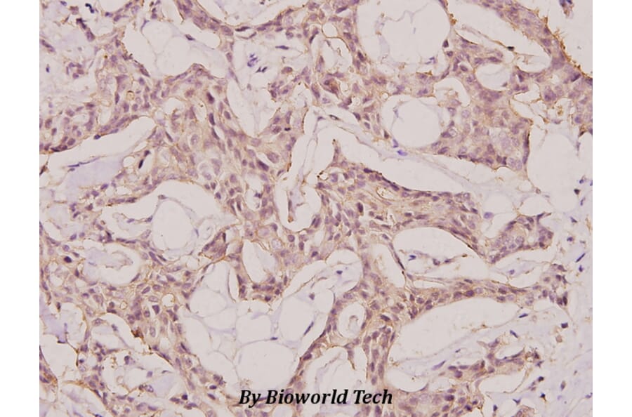 Anti-NY-CO-1 (K914) Antibody from Bioworld Technology (BS2456) - Antibodies.com