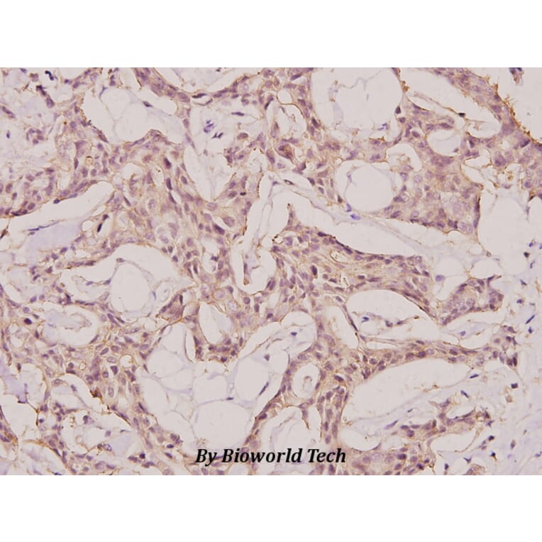 Anti-NY-CO-1 (K914) Antibody from Bioworld Technology (BS2456) - Antibodies.com