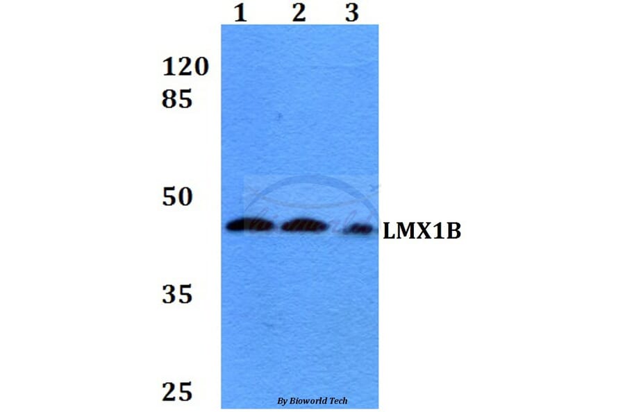 Anti-LMX1B (D159) Antibody from Bioworld Technology (BS2457) - Antibodies.com