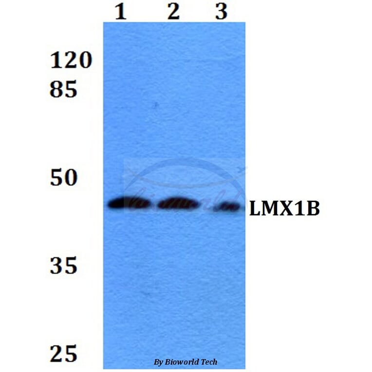 Anti-LMX1B (D159) Antibody from Bioworld Technology (BS2457) - Antibodies.com