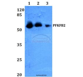 Anti-PFKFB2 (Y14) Antibody from Bioworld Technology (BS2458) - Antibodies.com