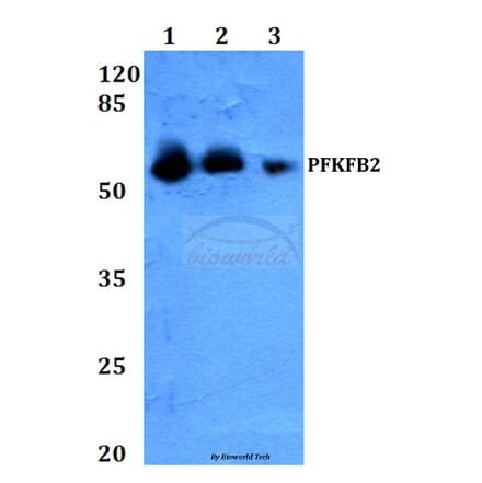 Anti-PFKFB2 (Y14) Antibody from Bioworld Technology (BS2458) - Antibodies.com