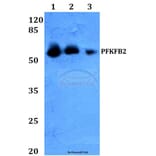 Anti-PFKFB2 (Y14) Antibody from Bioworld Technology (BS2458) - Antibodies.com