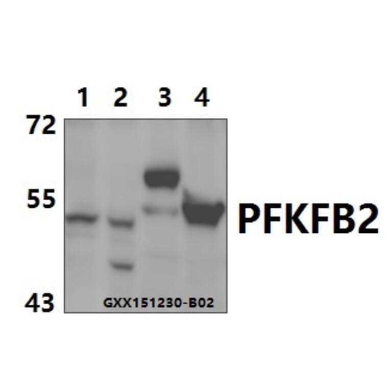 Anti-PFKFB2 (Y14) Antibody from Bioworld Technology (BS2458) - Antibodies.com