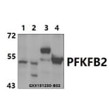 Anti-PFKFB2 (Y14) Antibody from Bioworld Technology (BS2458) - Antibodies.com