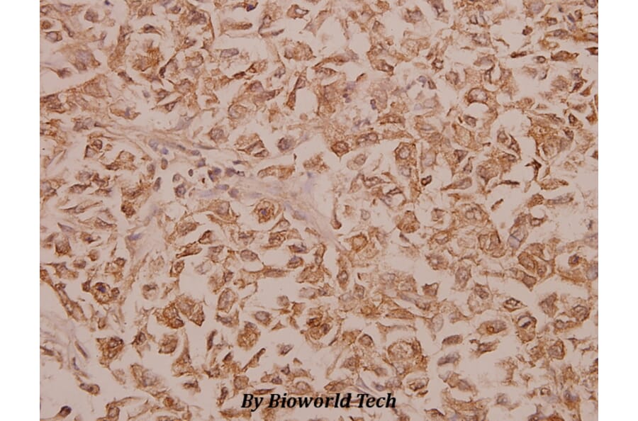 Anti-PFKFB2 (Y14) Antibody from Bioworld Technology (BS2458) - Antibodies.com