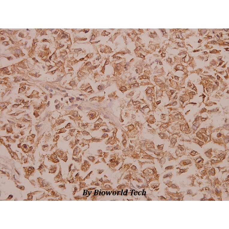 Anti-PFKFB2 (Y14) Antibody from Bioworld Technology (BS2458) - Antibodies.com