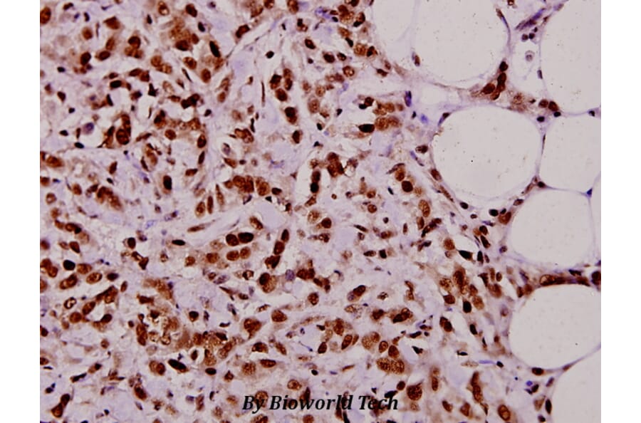 Anti-TAF5L (E323) Antibody from Bioworld Technology (BS2460) - Antibodies.com