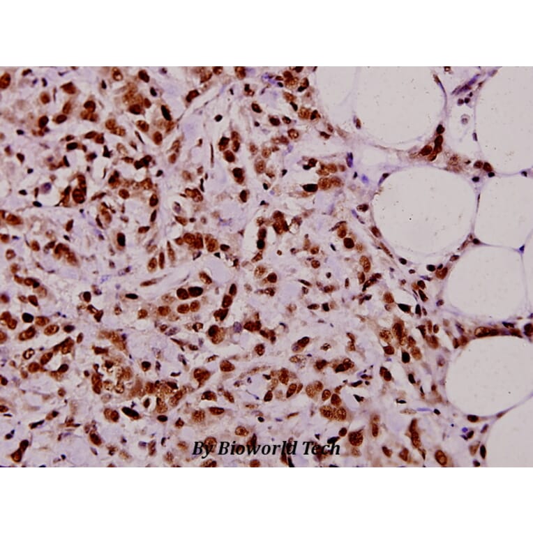 Anti-TAF5L (E323) Antibody from Bioworld Technology (BS2460) - Antibodies.com