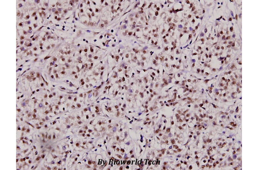 Anti-Myc (K422) Antibody from Bioworld Technology (BS2462) - Antibodies.com