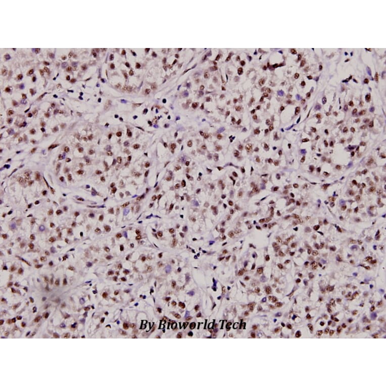 Anti-Myc (K422) Antibody from Bioworld Technology (BS2462) - Antibodies.com