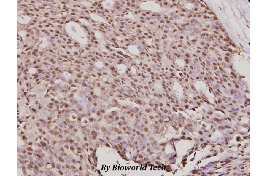 Anti-ErbB2/HER2 (K676) Antibody from Bioworld Technology (BS2463) - Antibodies.com