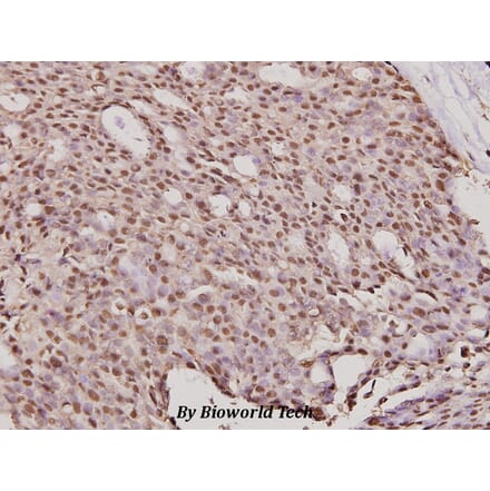 Anti-ErbB2/HER2 (K676) Antibody from Bioworld Technology (BS2463) - Antibodies.com