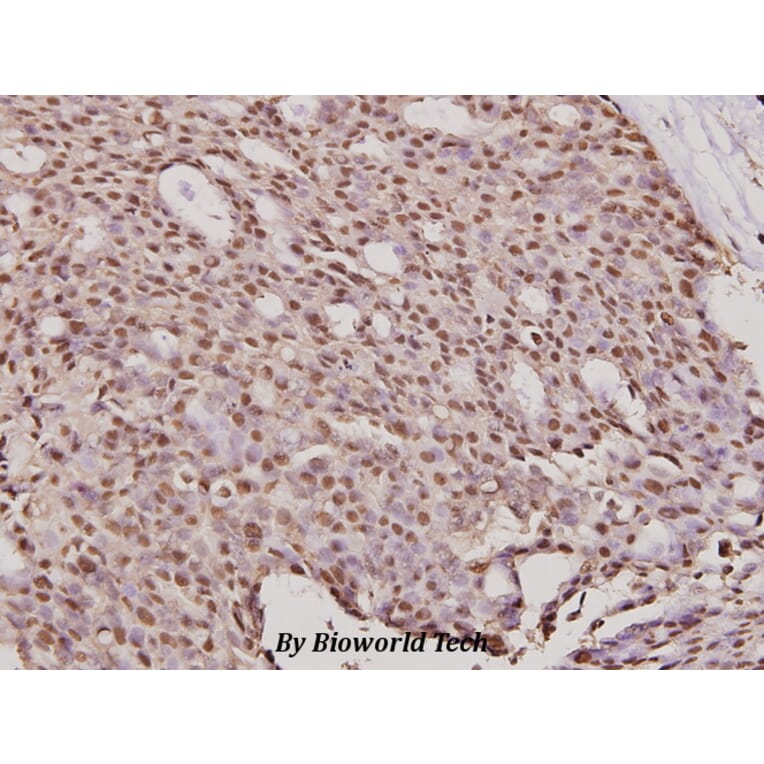 Anti-ErbB2/HER2 (K676) Antibody from Bioworld Technology (BS2463) - Antibodies.com